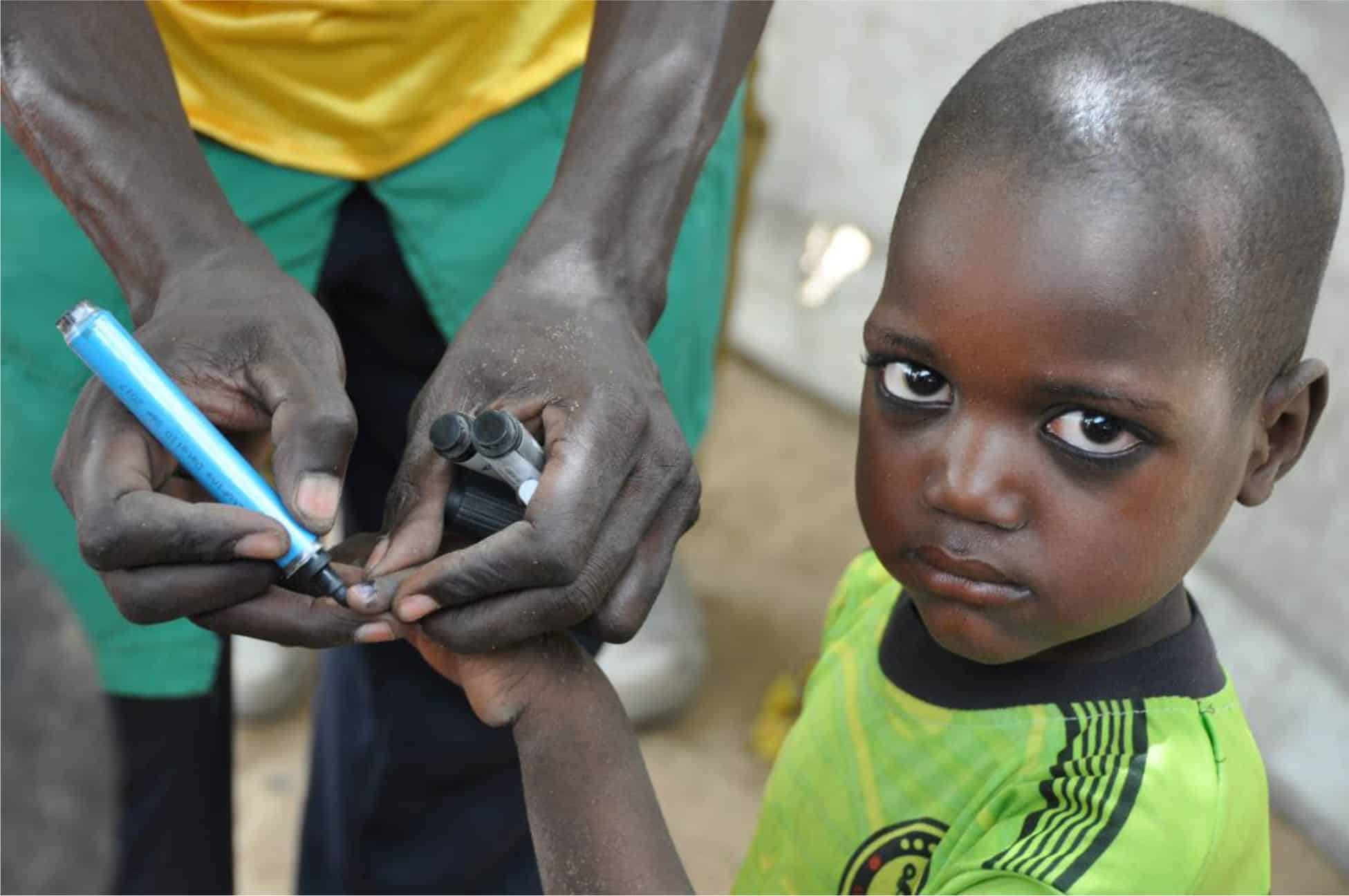a child's finger marked to indicate being vaccinated in Chad